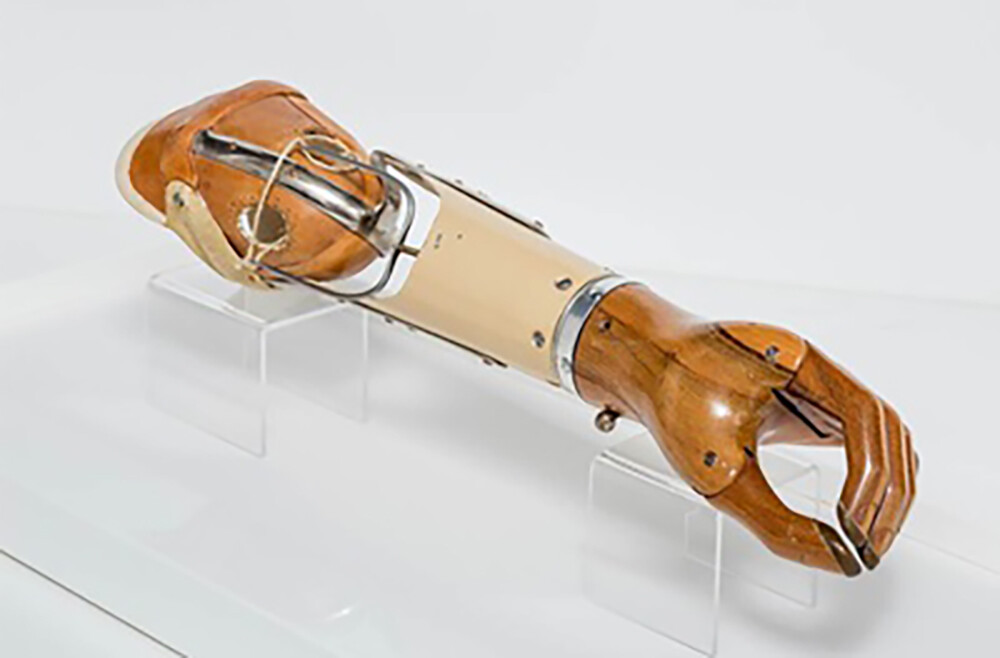 prosthetic_arm