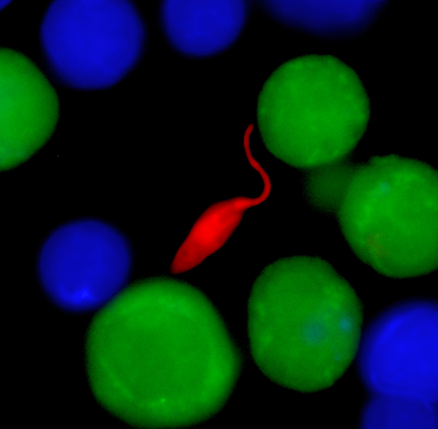 leishmaniasis through the microscope