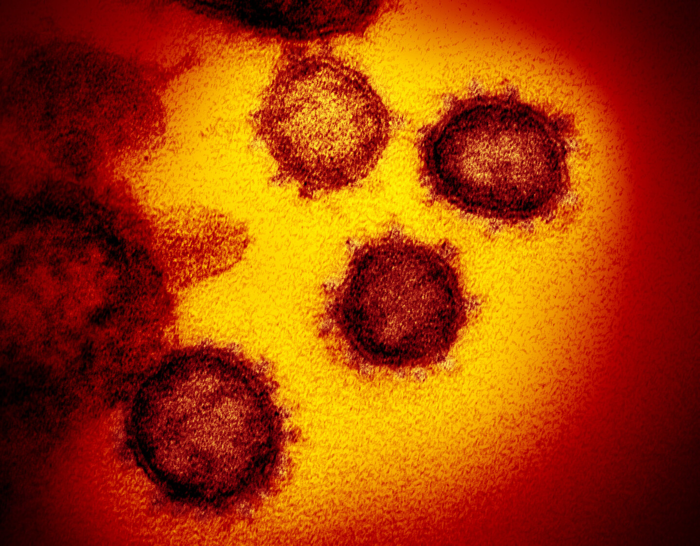 microscopic image of covid-19