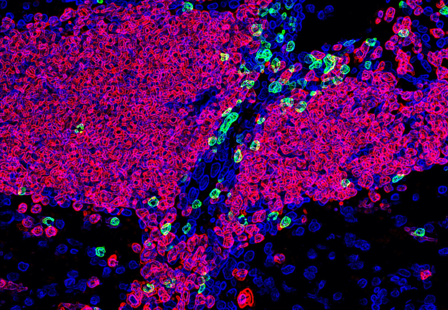 Microscopic image of cells labeled blue, green, and pink