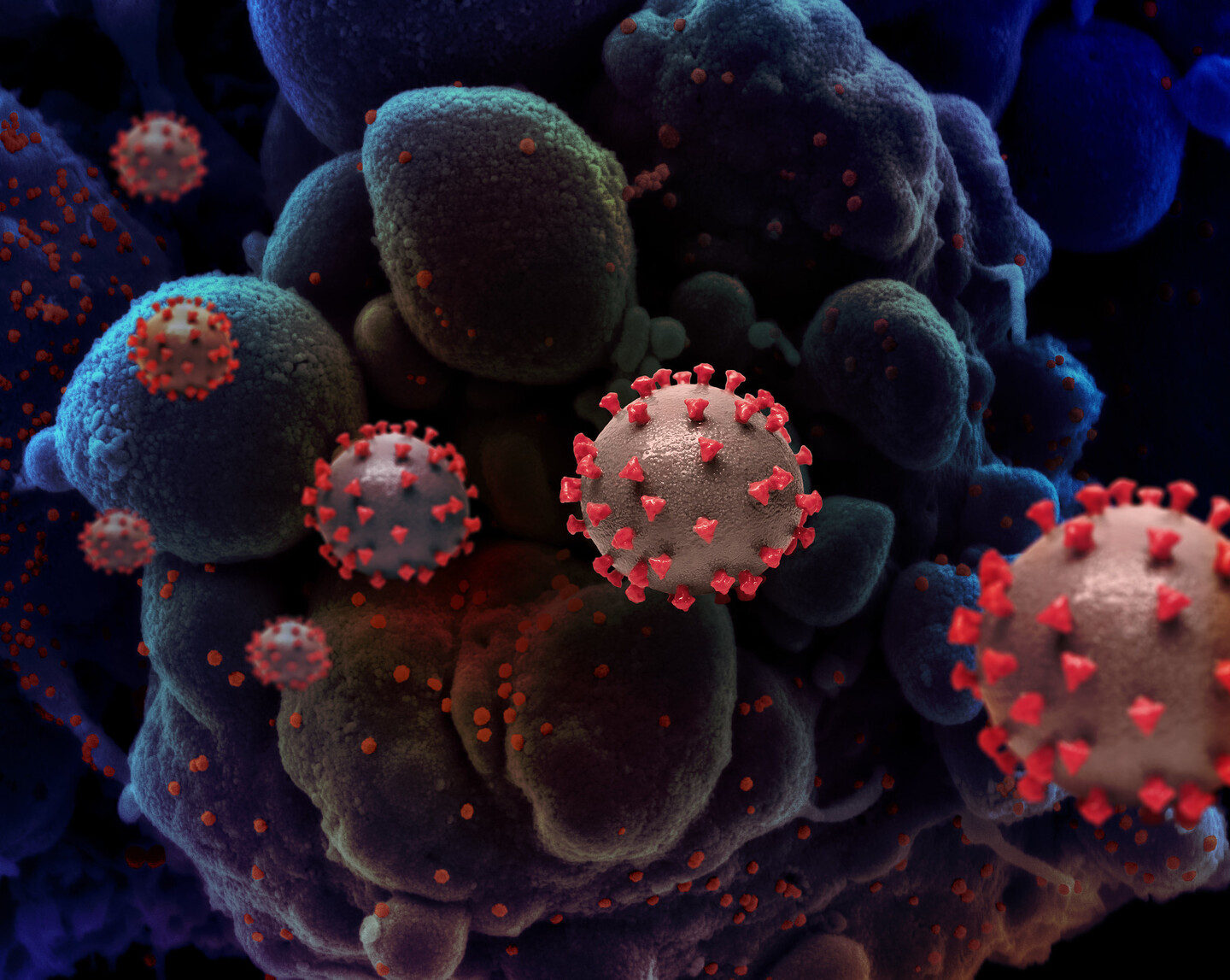 covid-19 virus