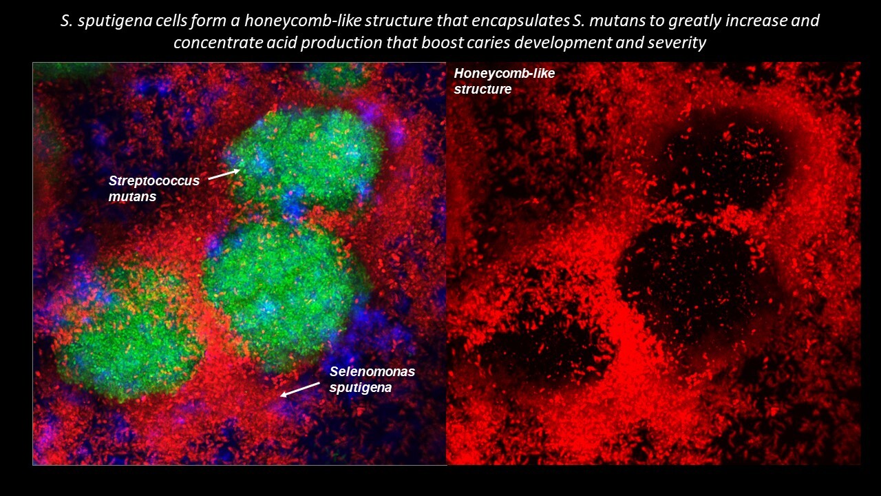 Two microscopic slides showing bacteria.