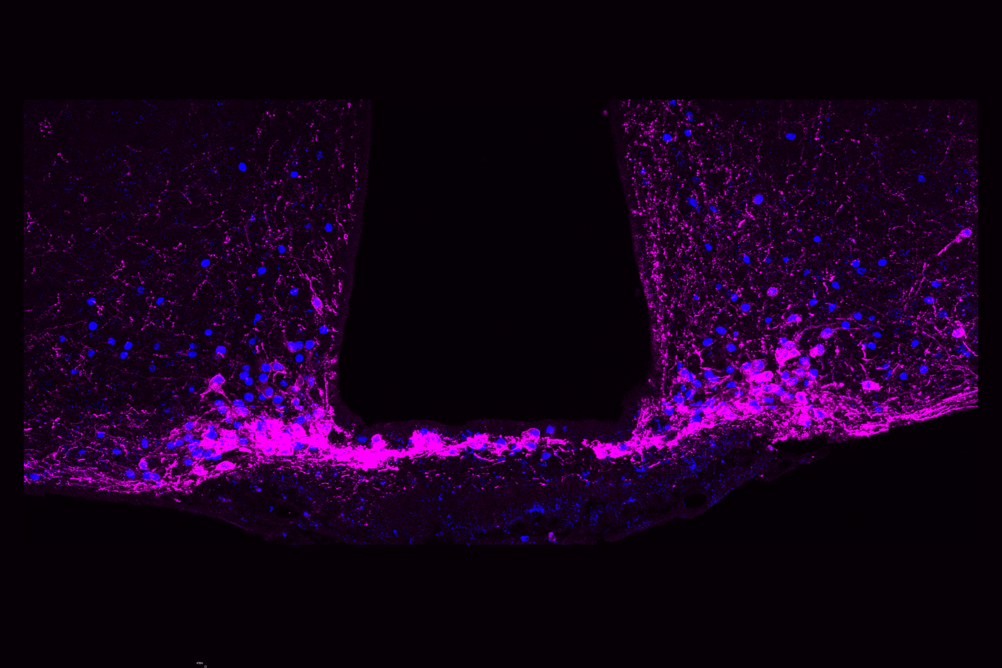 Fluorecent imageing of hunger neurons in the brain