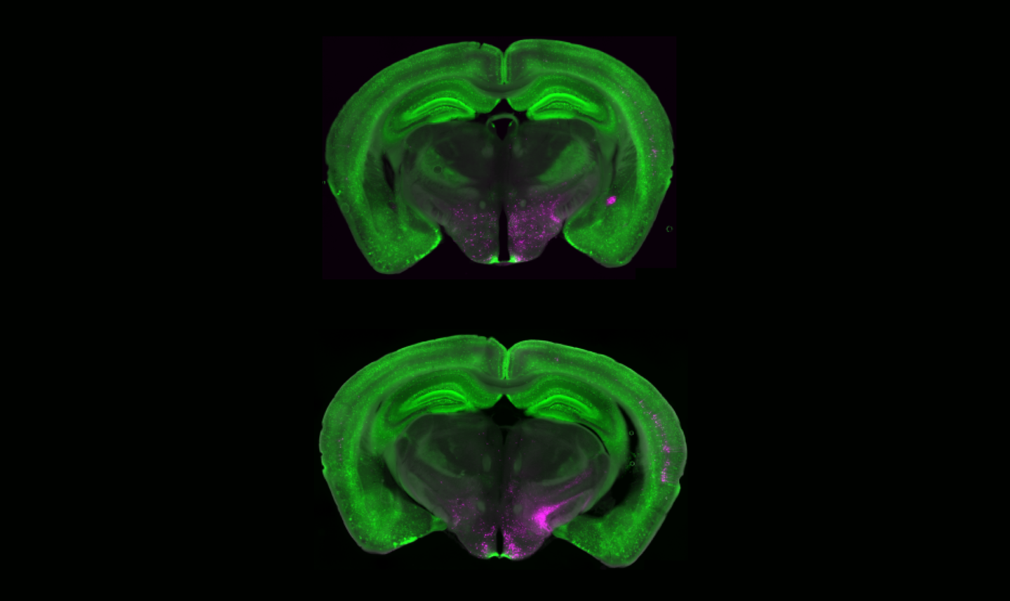 Brain imaging - fluorescence