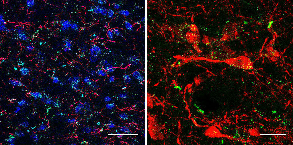 Research from Penn’s Heath Schmidt revealed that drugs already approved by the FDA to treat diabetes and obesity may reduce cocaine relapse and help addicted people break the habit