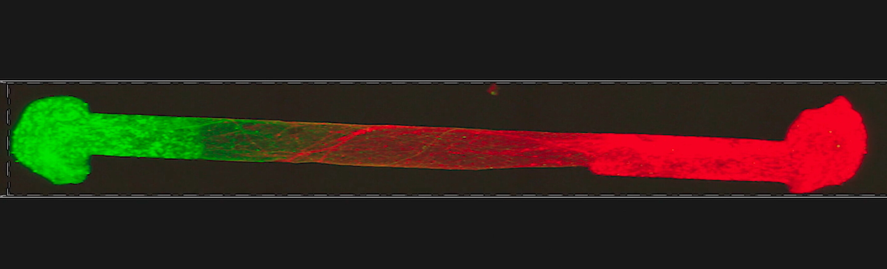 A radical, innovative approach by a neurosurgeon takes a big step forward 