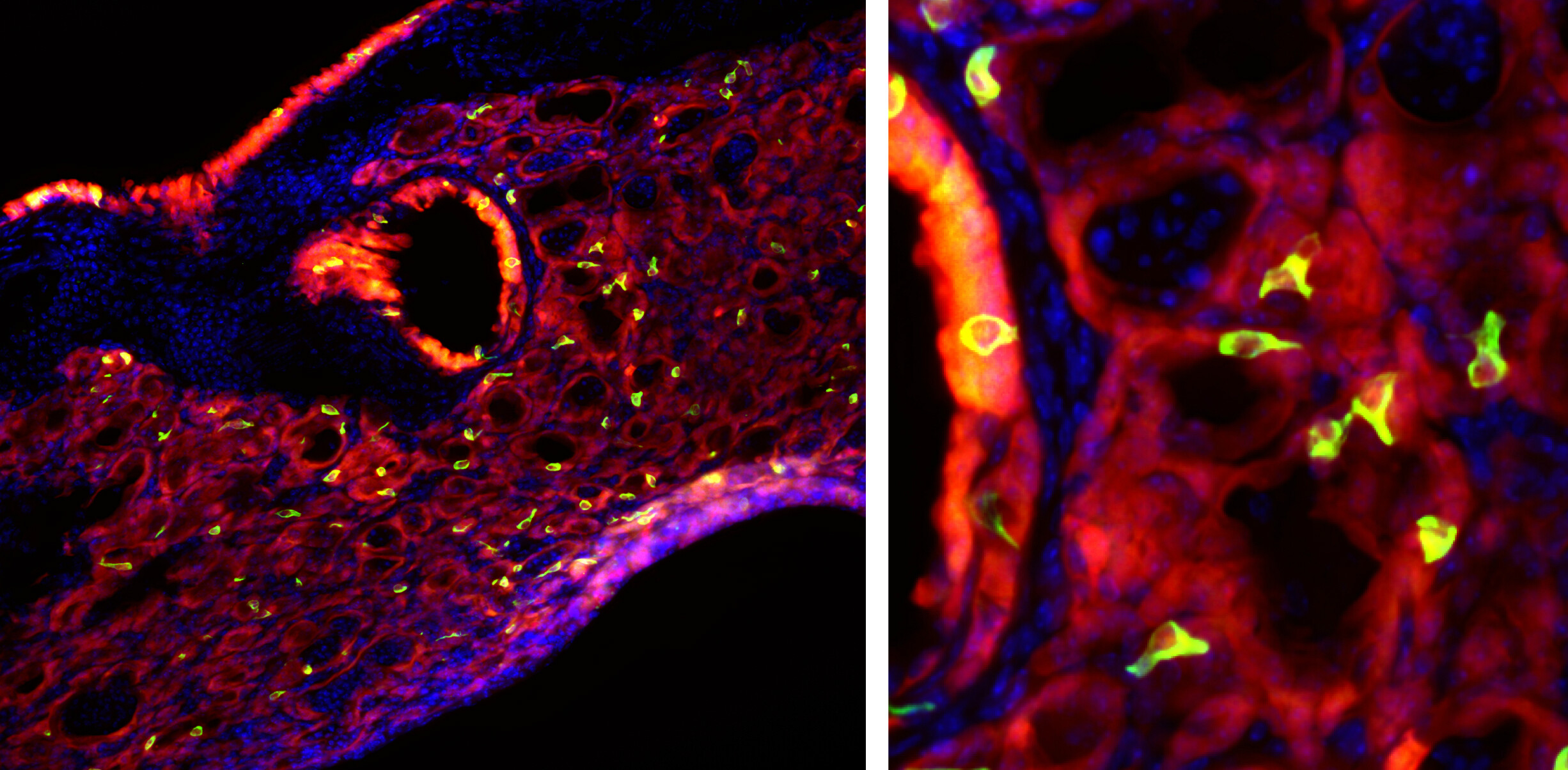 Microscopic images of fluorescent cells show up green against a red and blue background. The green glowing cells are elongated in shape.