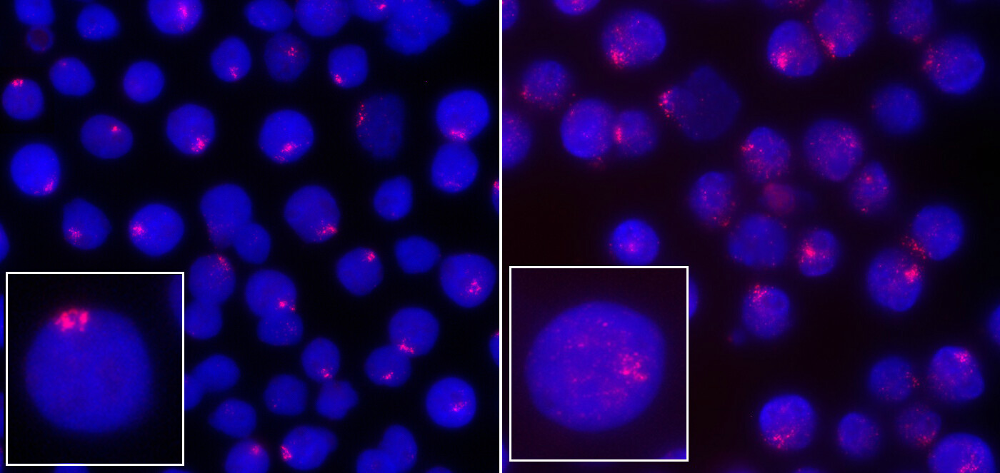 Two panels, each with an inset images, show blue cells with pink genetic material highlighted. The pink areas are defined in the left panel and more diffuse in the right panel.