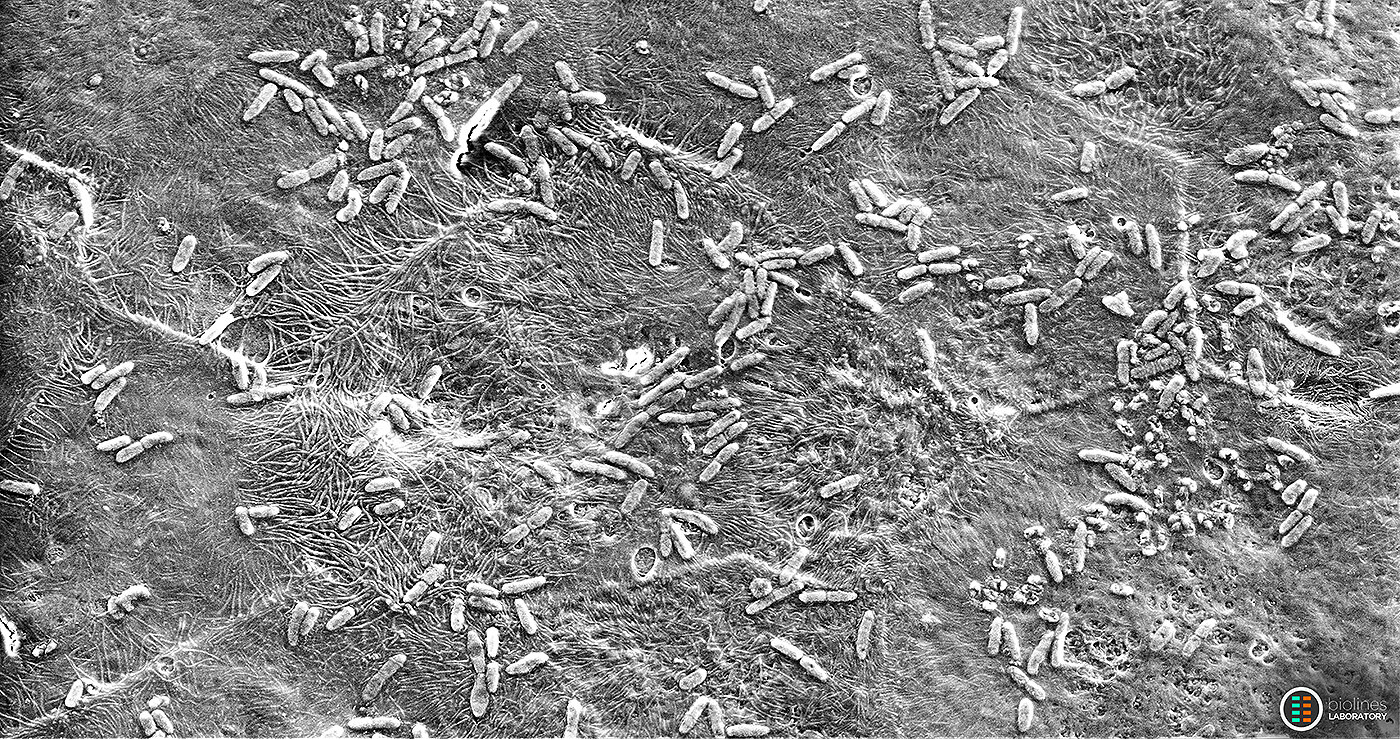 Microscopy photo of Infected airway