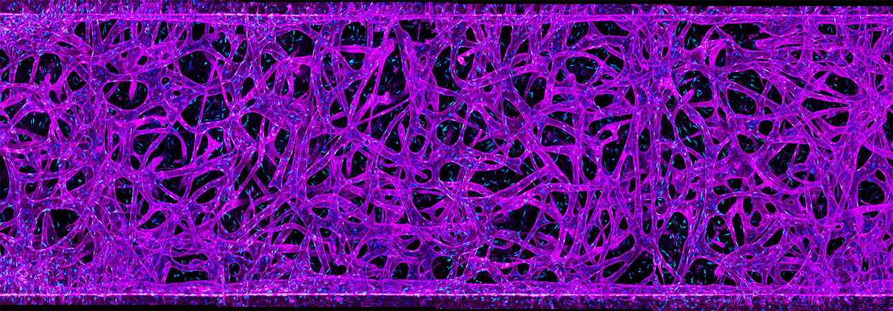 Blood vessels