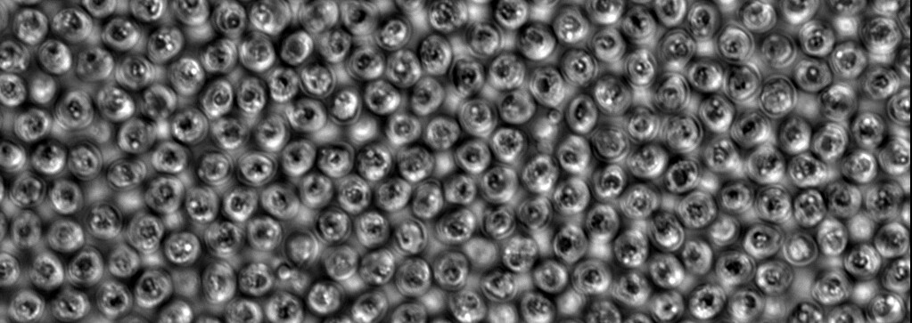 Black and white microscopic image of many cells clustered tightly