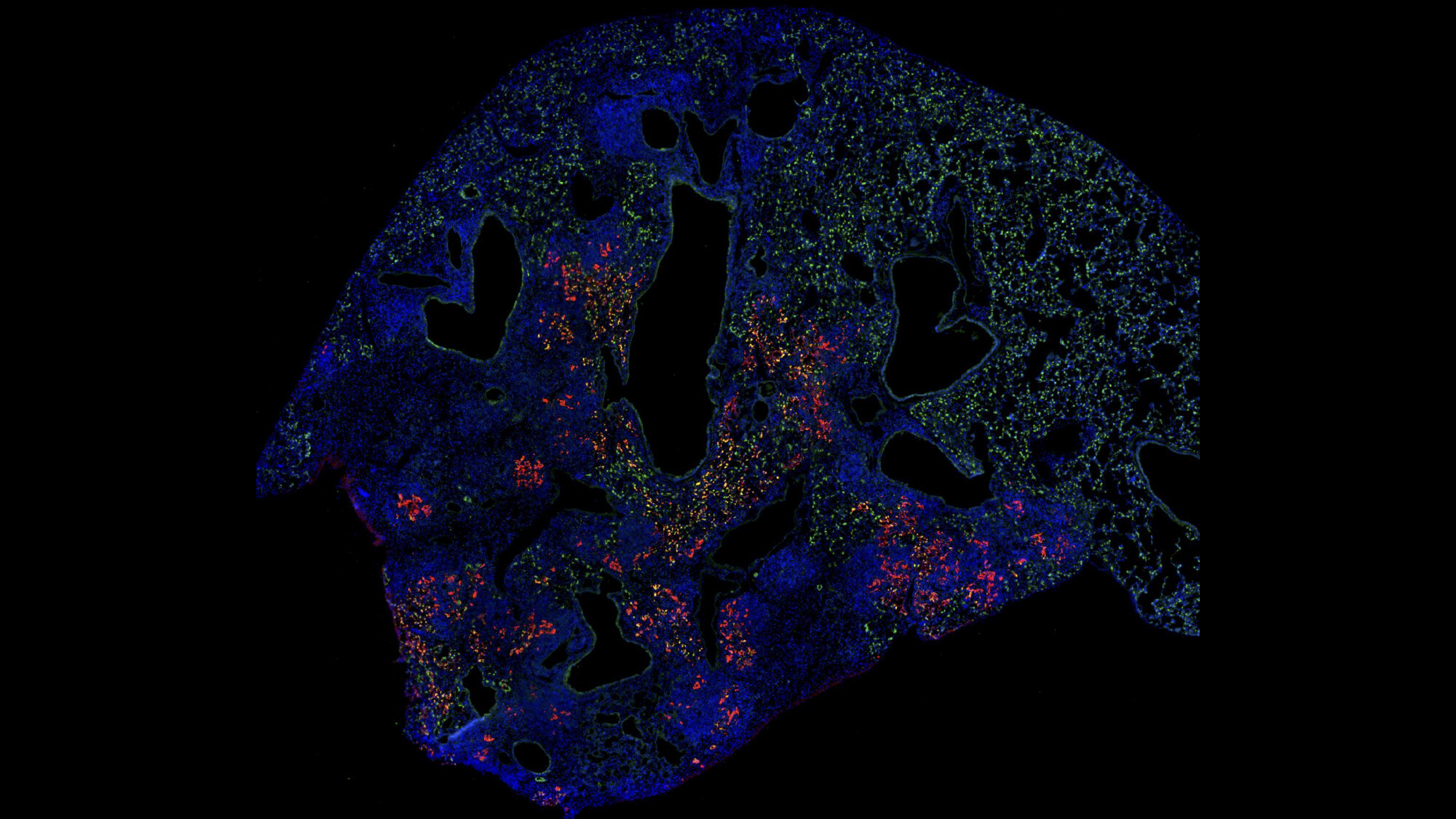 Colorful fluorescent labeled cells appear in a tissue sample of a lung