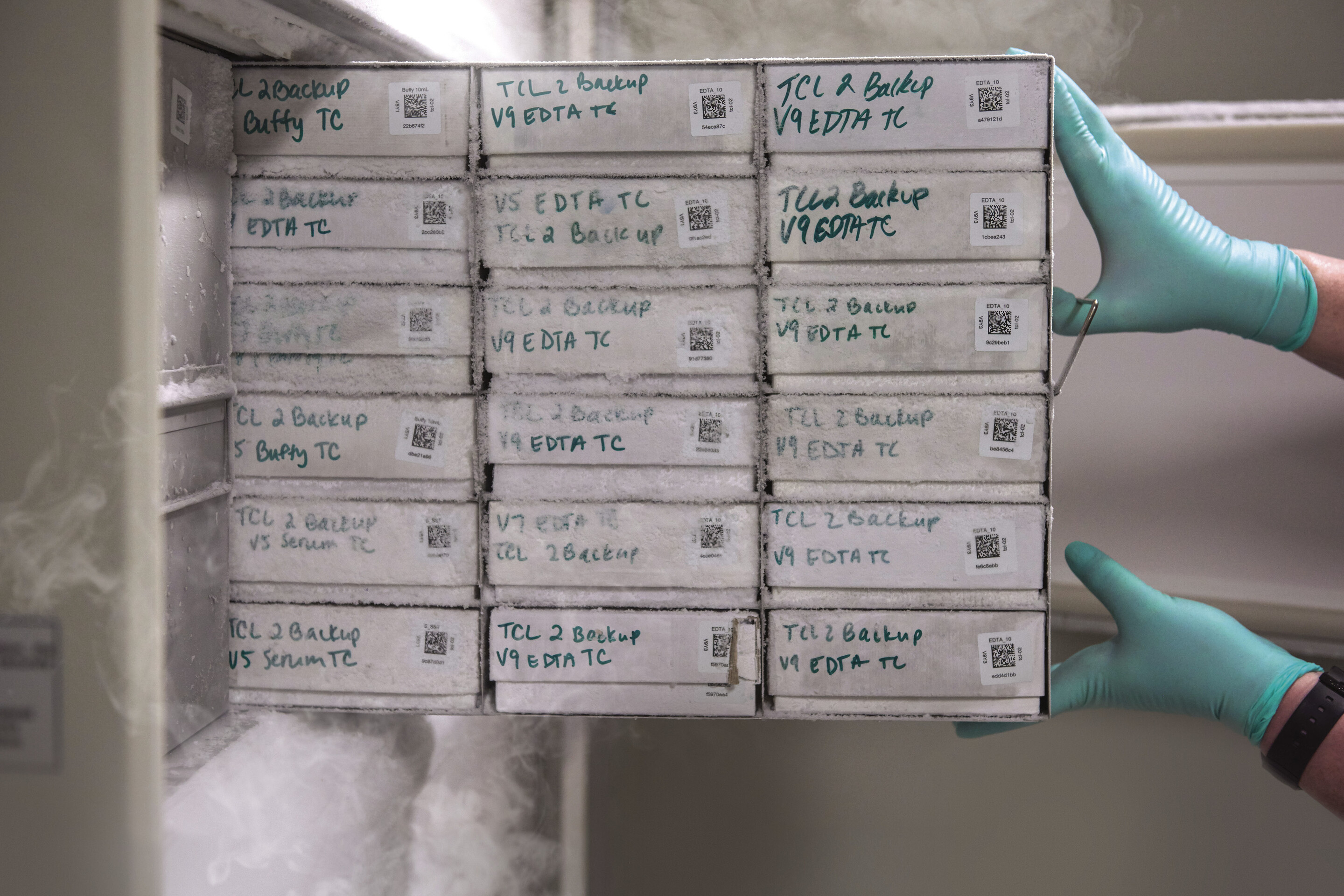 kidney freezer farm