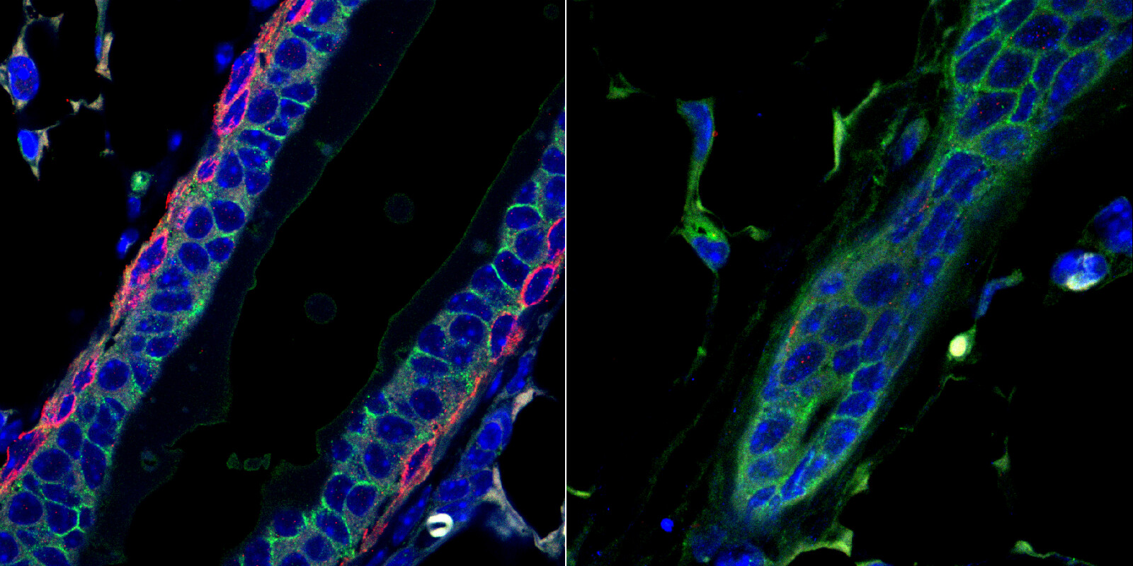 Side-by-side microscope images of a mammary gland duct. Right panel shows it is less well formed.
