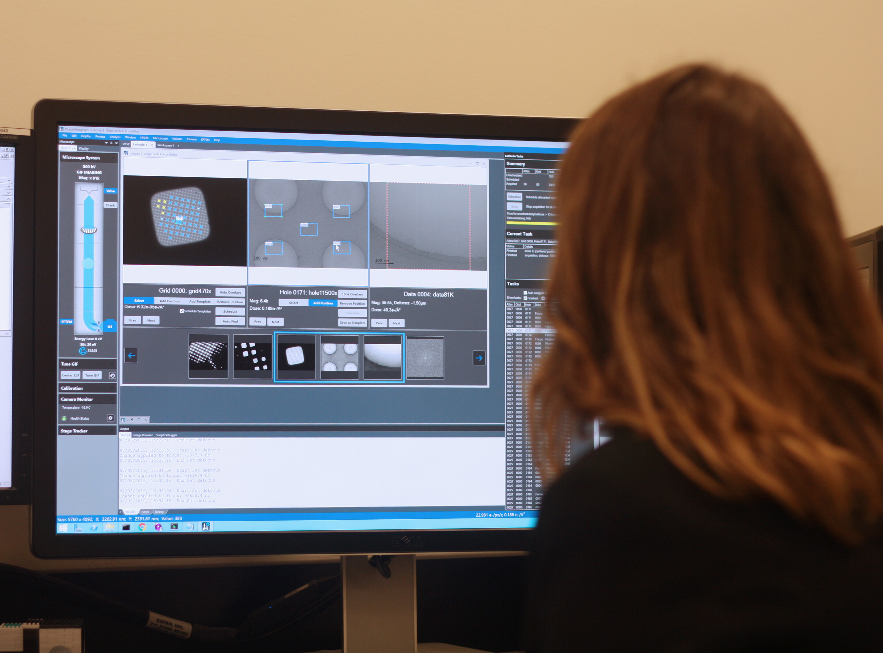 Person looking at a large desktop computer screen with microscopic images on the screen.