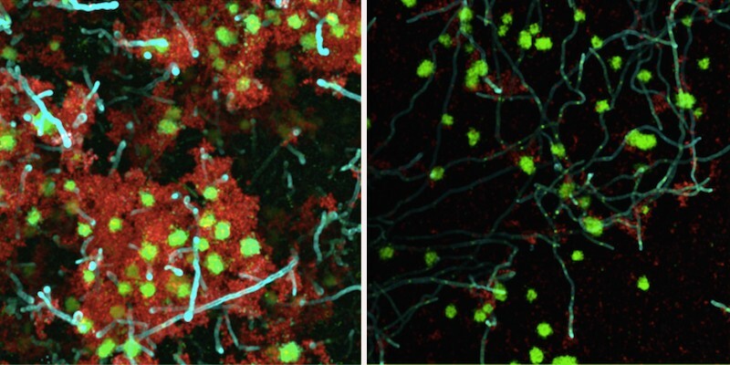 side-by-side microscopic images of microbes with fluorescent labels, with right side looking more empty
