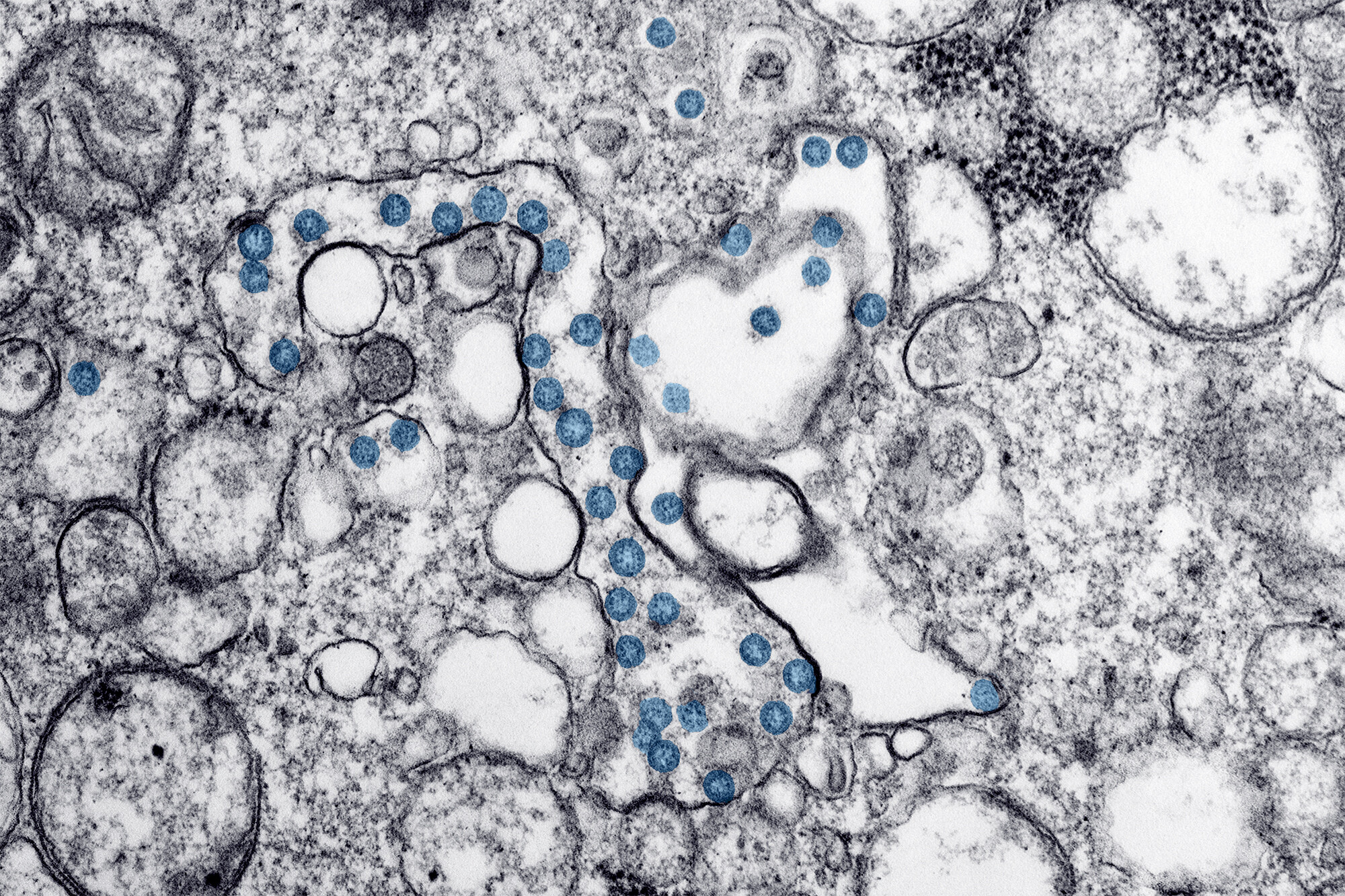 covid 19 virus
