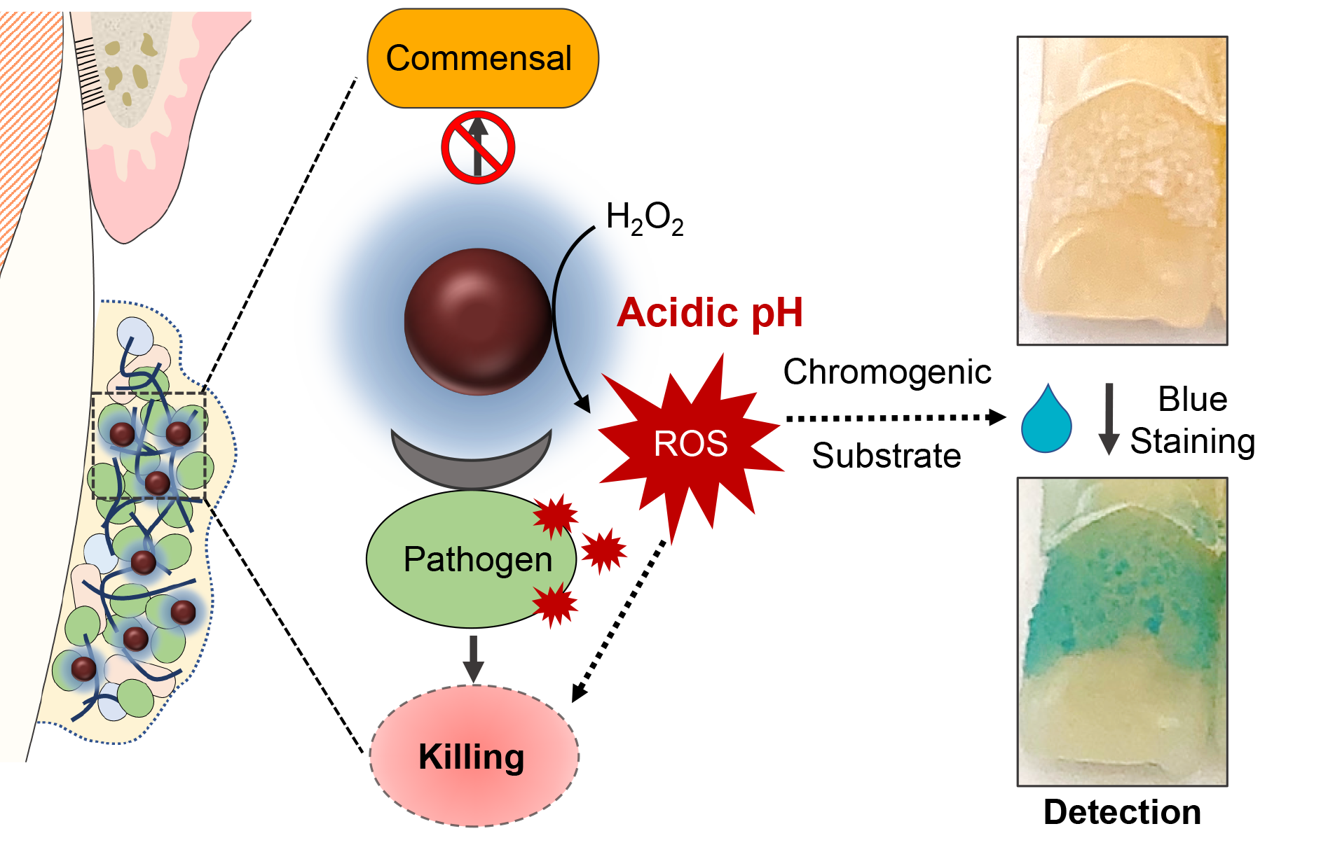 diagray showing how a nanoparticle can respond to bacteria in the mouth and kill pathogens