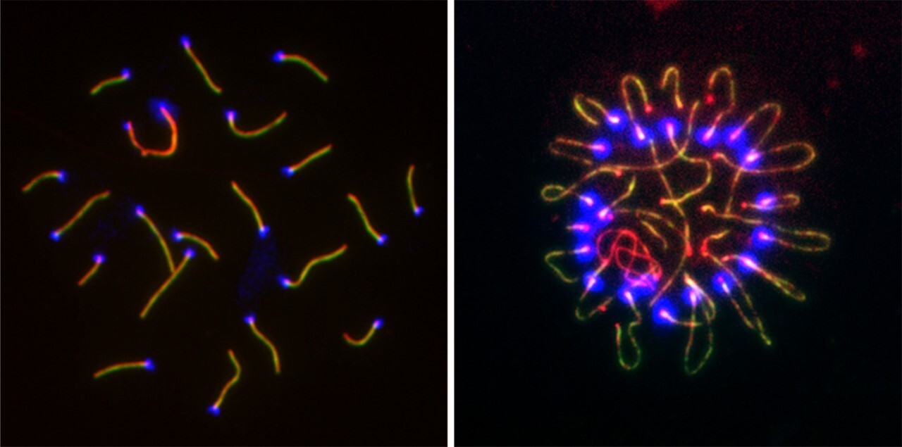 Side by side images show abnormal clustering of chromosomes, labeled with florescent purple and yellow