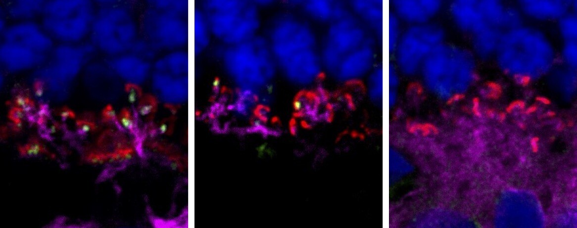 Three panels show fluorescent images of therapeutic gene LRIT3, which corrects a form of night blindness.