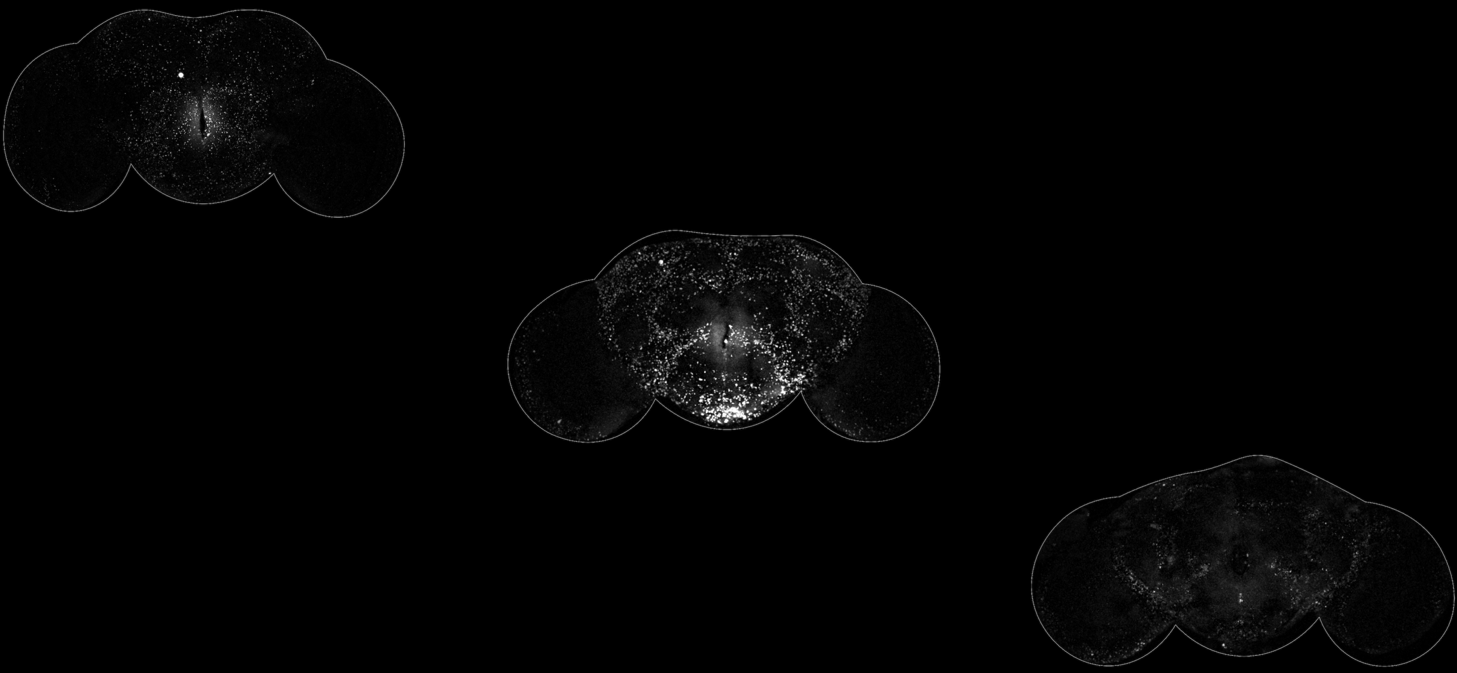 Microscopy images of fly brains with lipid deposits.