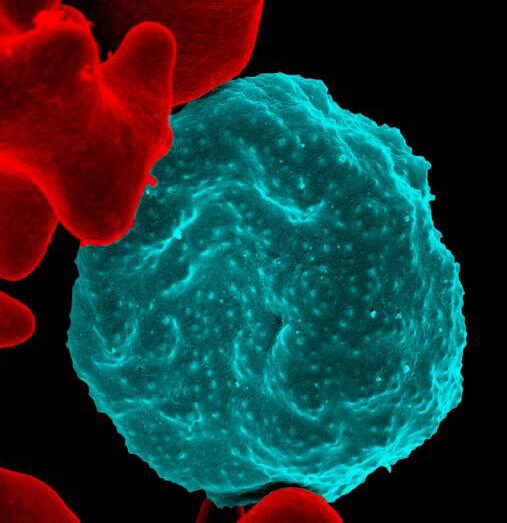 malaria