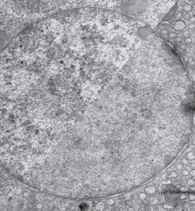 side-by-side comparison of two nuclei with different compaction