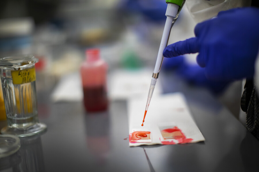 practicing blood smears on slides