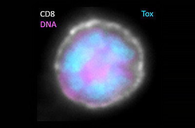 Tox protein in DNA