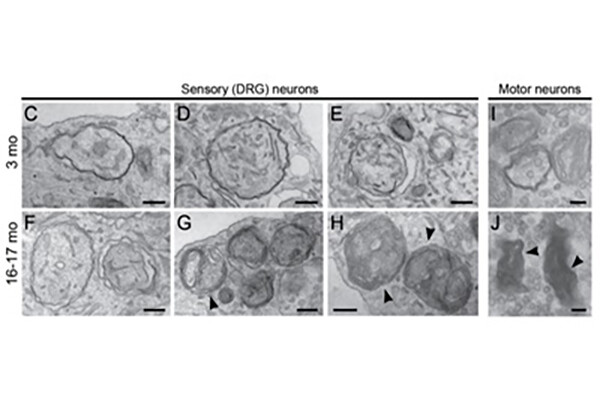 Eight photos showing a microscopic view of the destruction of neurons in a cell.