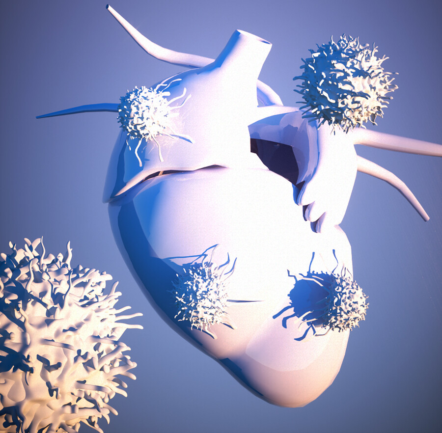 Rendering of tumors surrounding a heart