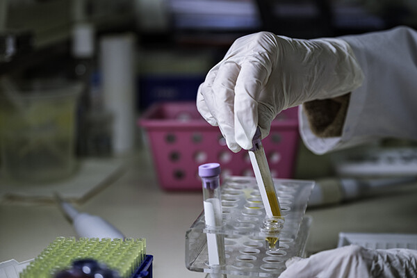 Lab technician with a sample of plasma blood analyzing the results