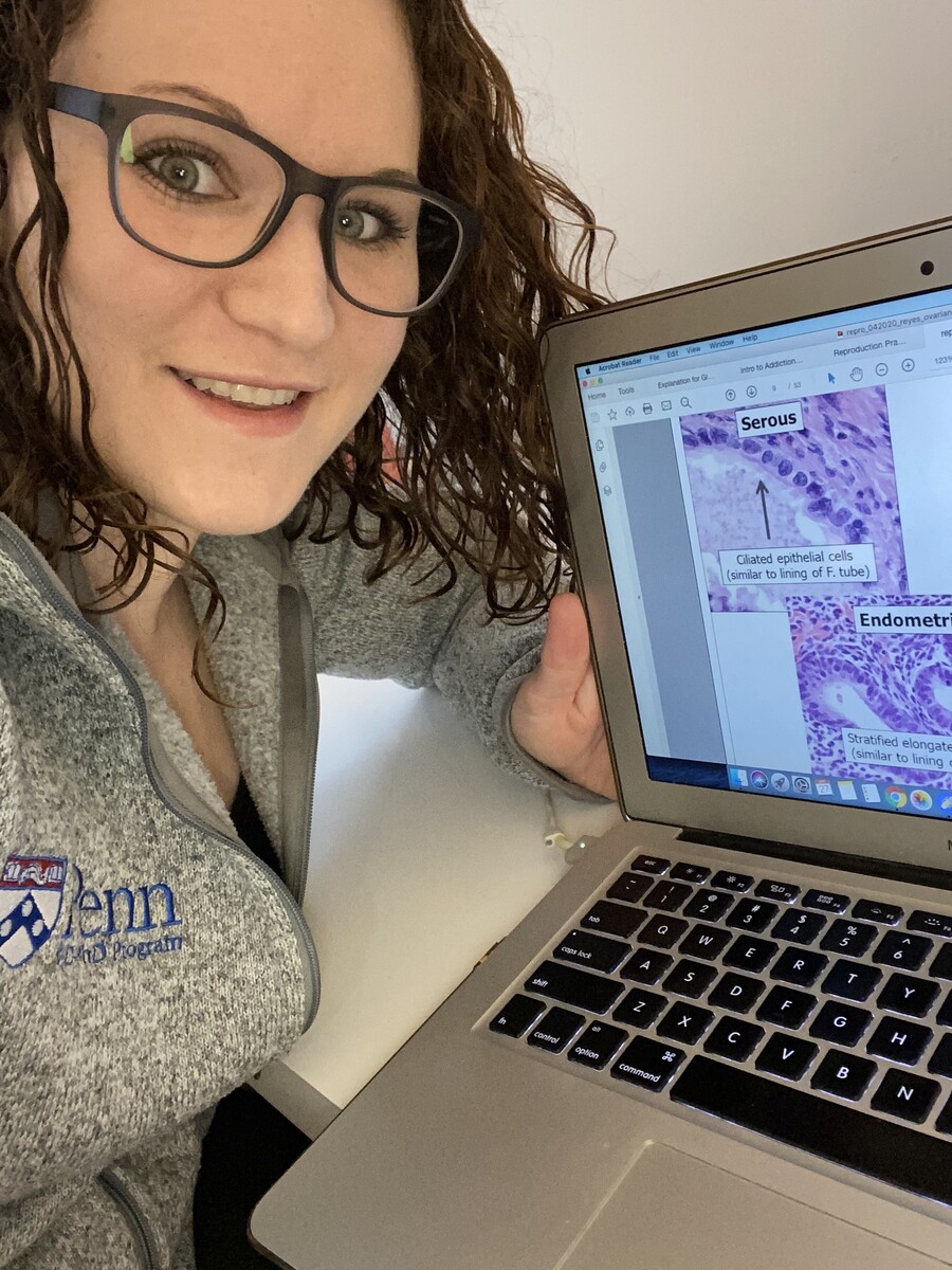 Noa Erlitzki shows her medical school online coursework on her laptop