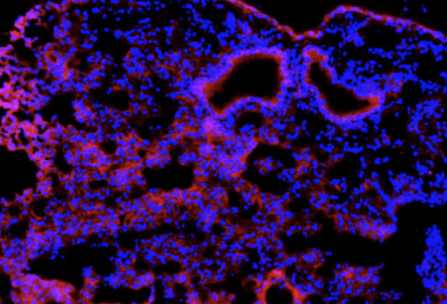 Fluorescent microscopic image of lung tissue stained in blue and pink