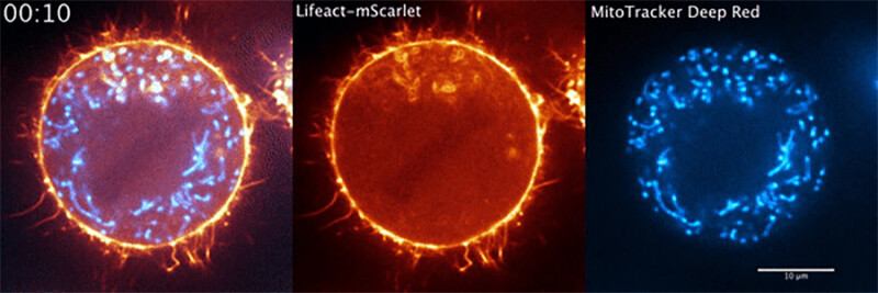 molecules showing the cyclic assembly and disassembly of actin (in orange) on mitochondria (in blue) in dividing HeLa cells