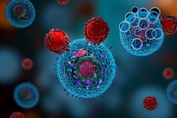 microscopic view of pancreatic cancer cells.