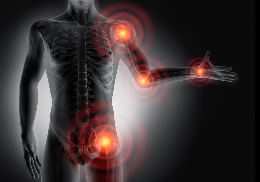 Image showing body with shoulder, wrist, elbow, and hip joints in red indicating pain and inflammation