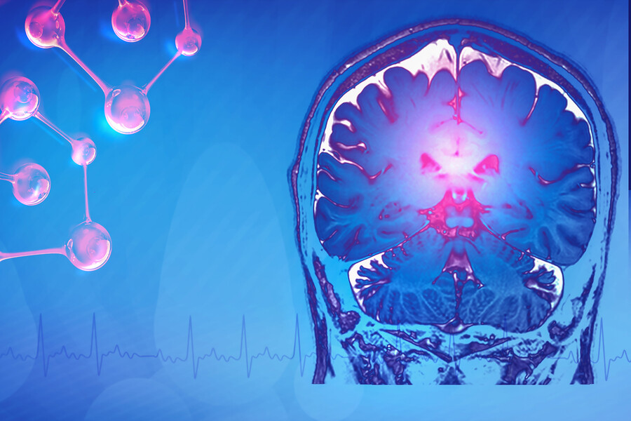 A brain scan with highlighted genetic activity.
