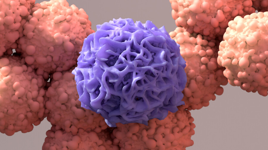 Microscopic view of a macrophage devouring a cancer cell.