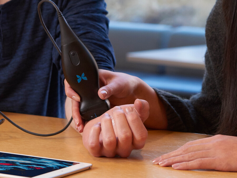 ultrasound scanner on a wrist