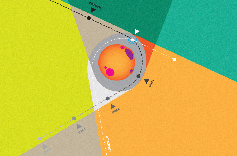 A chart showing the intersection of a cell as it changes from pre-cancer to cancer stage one and two.