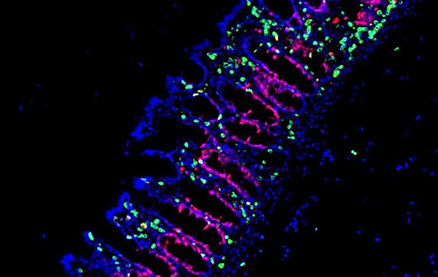 microscopic view of bone marrow 