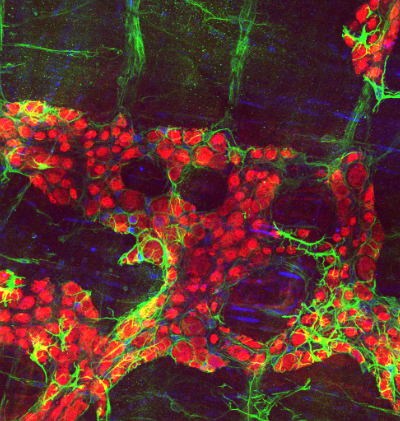 Microscopic view of neurons in the intestines.