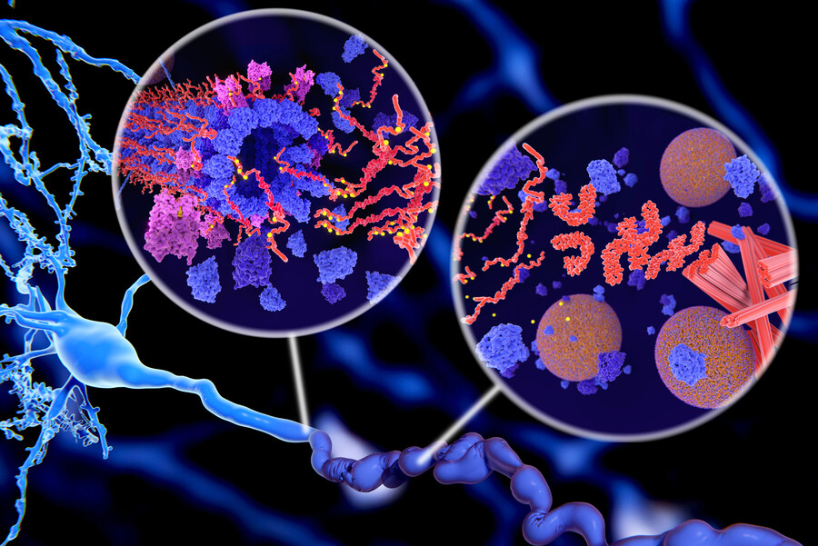 Microscopic rendering of tau proteins disintegrating microtubuli in a neuron axon.