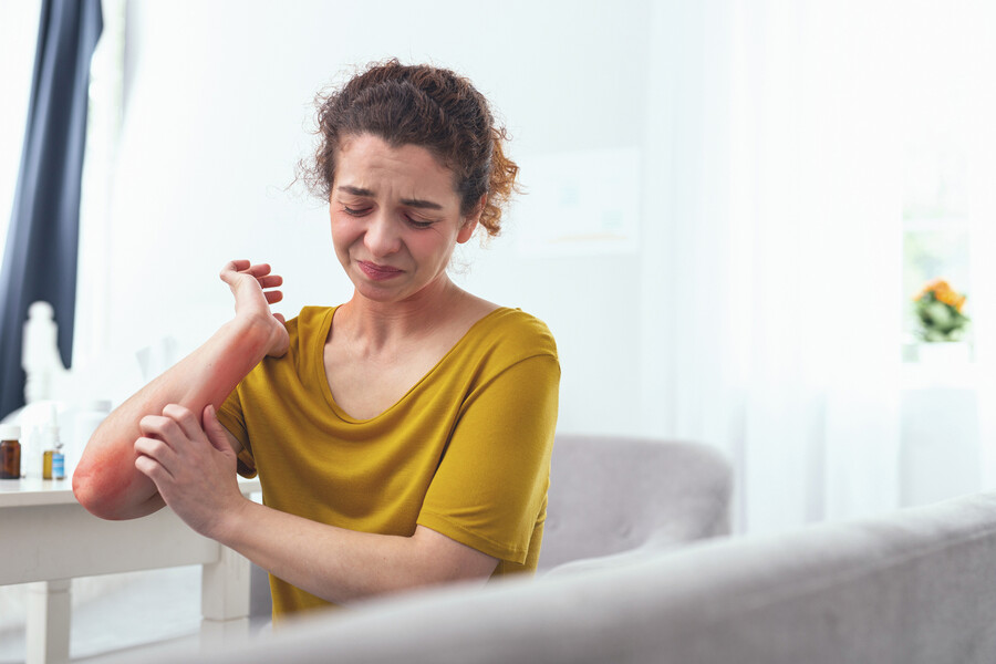 Person scratching at dermatitis on their arms.