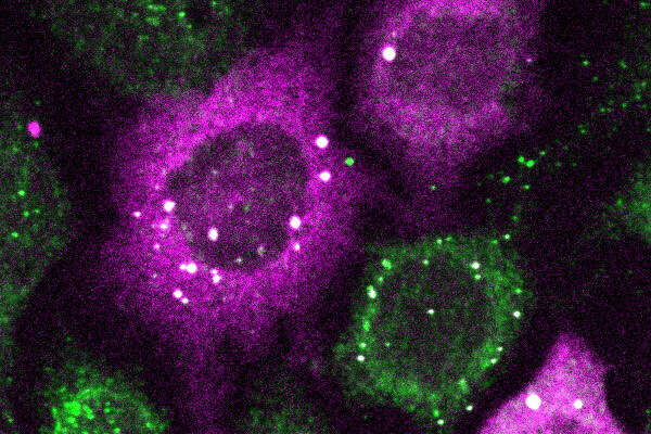 Microscopic image of tiny clusters of proteins detected by CluMPS.&nbsp; &nbsp; &nbsp;