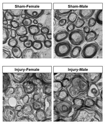 Four X-rays of male and female brains.
