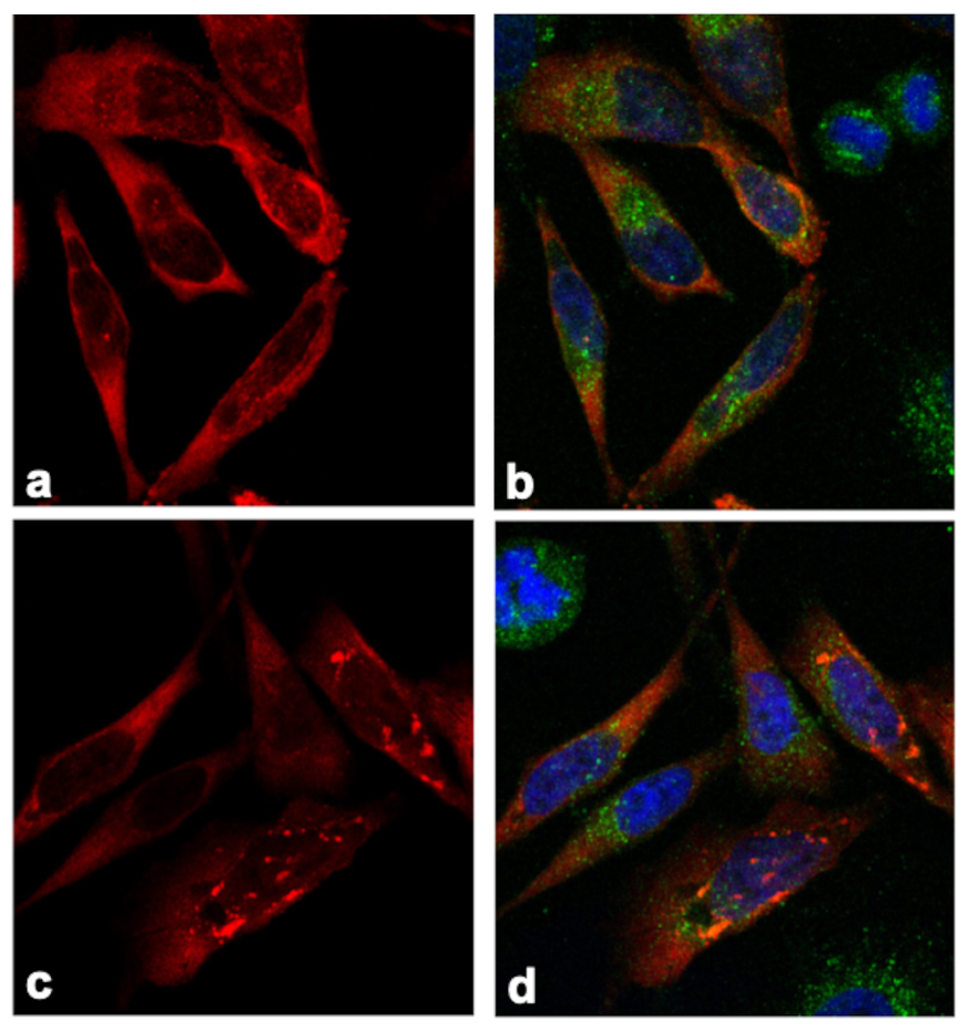 Cellular localization of normal (wild-type [WT]) and A536del mutant GTPBP2 proteins.