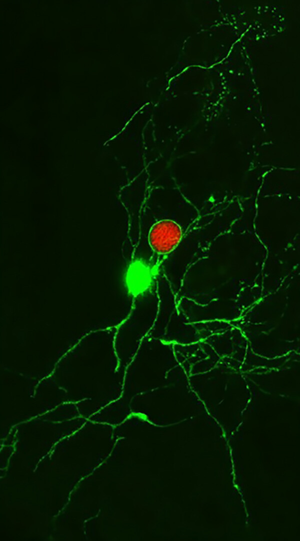 Toxoplasma gondii in brain.