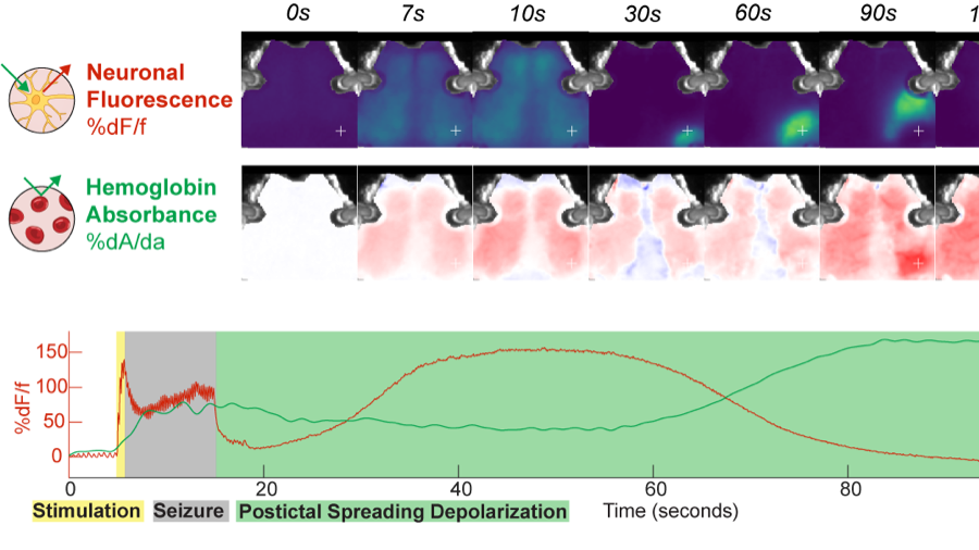 Scans showing neuronal fluorescence and hemoglobin absorption